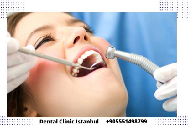 أسعار علاج الأسنان في تركيا