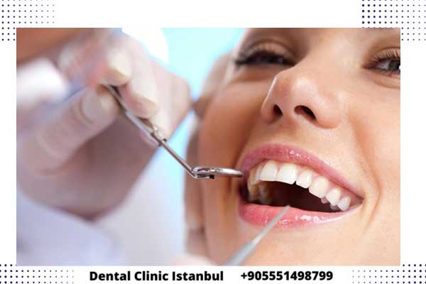أنواع تجميل الاسنان في تركيا