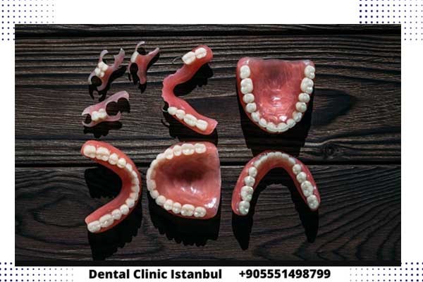 أنواع جسور الأسنان في تركيا