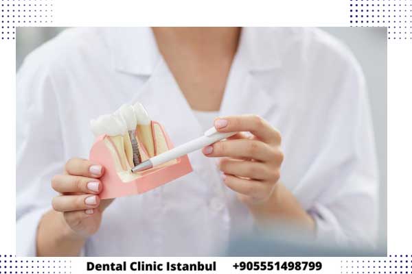 اسعار اطباء الاسنان في تركيا