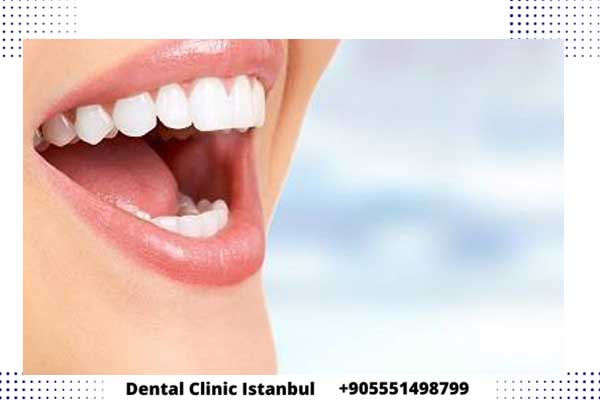 تقنيات تجميل الاسنان في تركيا