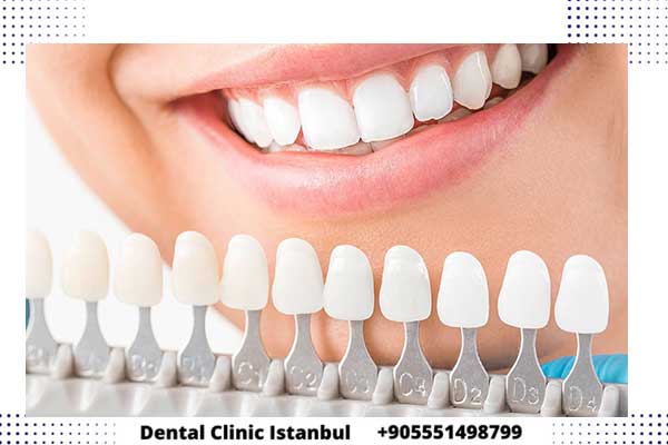 تلبيس الأسنان في تركيا