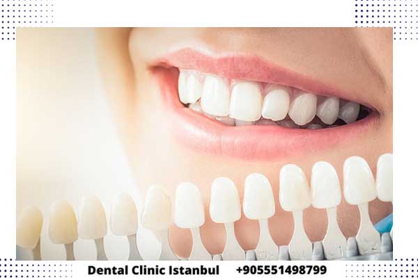 سعر تركيبات الأسنان في تركيا