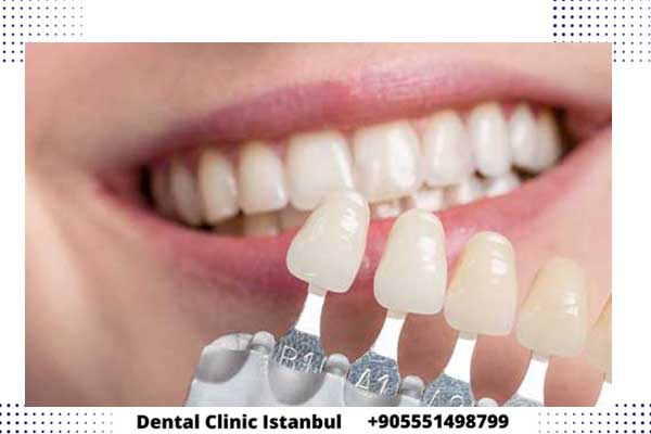 اسعار تلبيس الأسنان الزيركون في تركيا