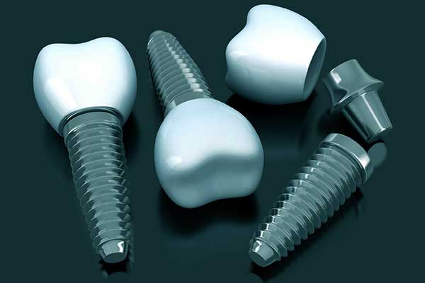 Choisir la bonne marque d’implants dentaires