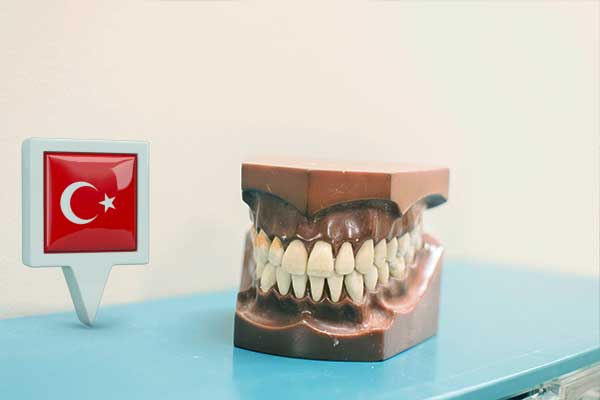 Tourisme dentaire en Turquie