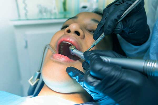 impianto dentale preparazione Completa per Garantire un Successo Duraturo