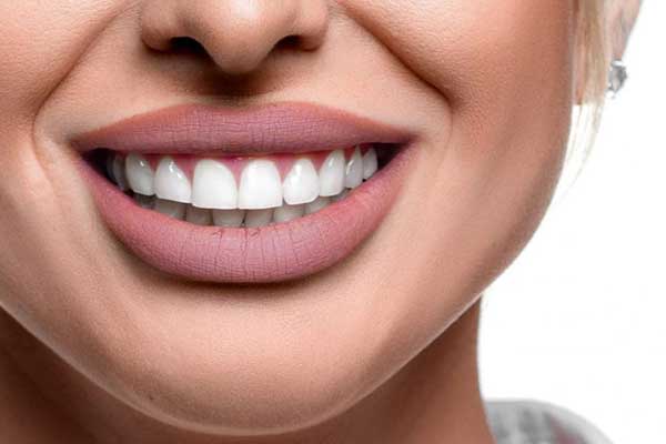 Impianto Dentale Singolo Dente: Tutto Quello Che Devi Sapere