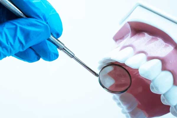 Impianto Dentale Corto: La Soluzione Efficace per le Situazioni di Osso Limitato