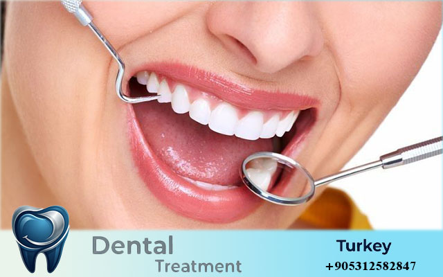 Dentist in Turkey for Foreigners: 7 Smart Reasons People Choose Turkey for Dental Care