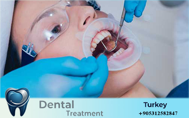 All on 6 Dental Implants Turkey