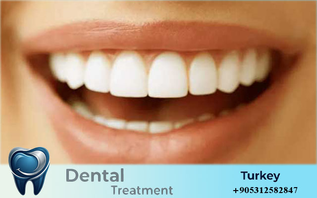How Much Do Dental Implants Cost in Turkey