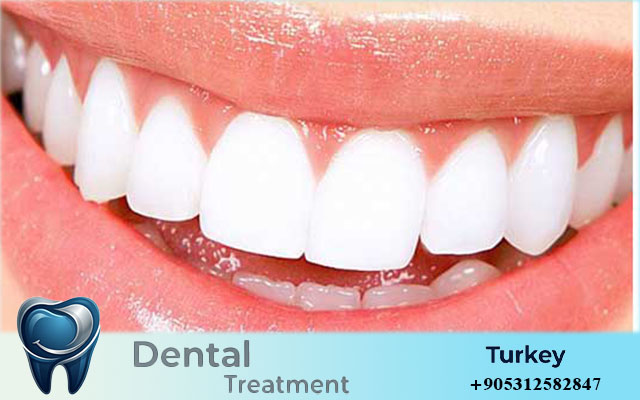 Dental Treatment Turkey Prices