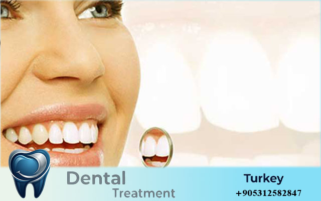 Hollywood Smile Turkey