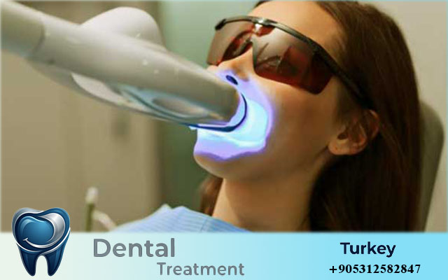 smile makeover turkey