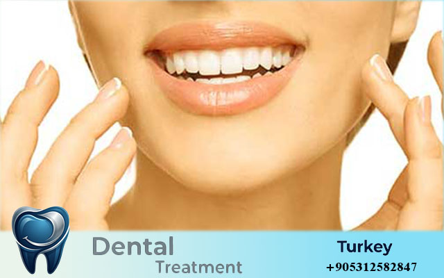 veneers in turkey for foreigners